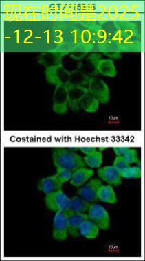 brinquedo nerf beto carrero brinquedo nerf beto carrero